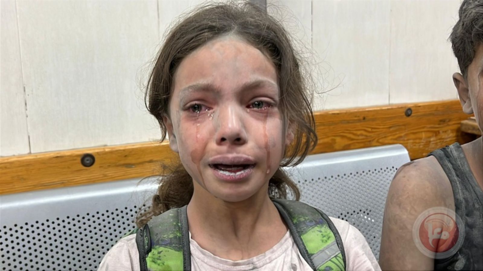 75 شهيدا و304 إصابات جديدة خلال يوم في قطاع غزة 75 شهيدا و304 إصابات جديدة خلال يوم في قطاع غزة